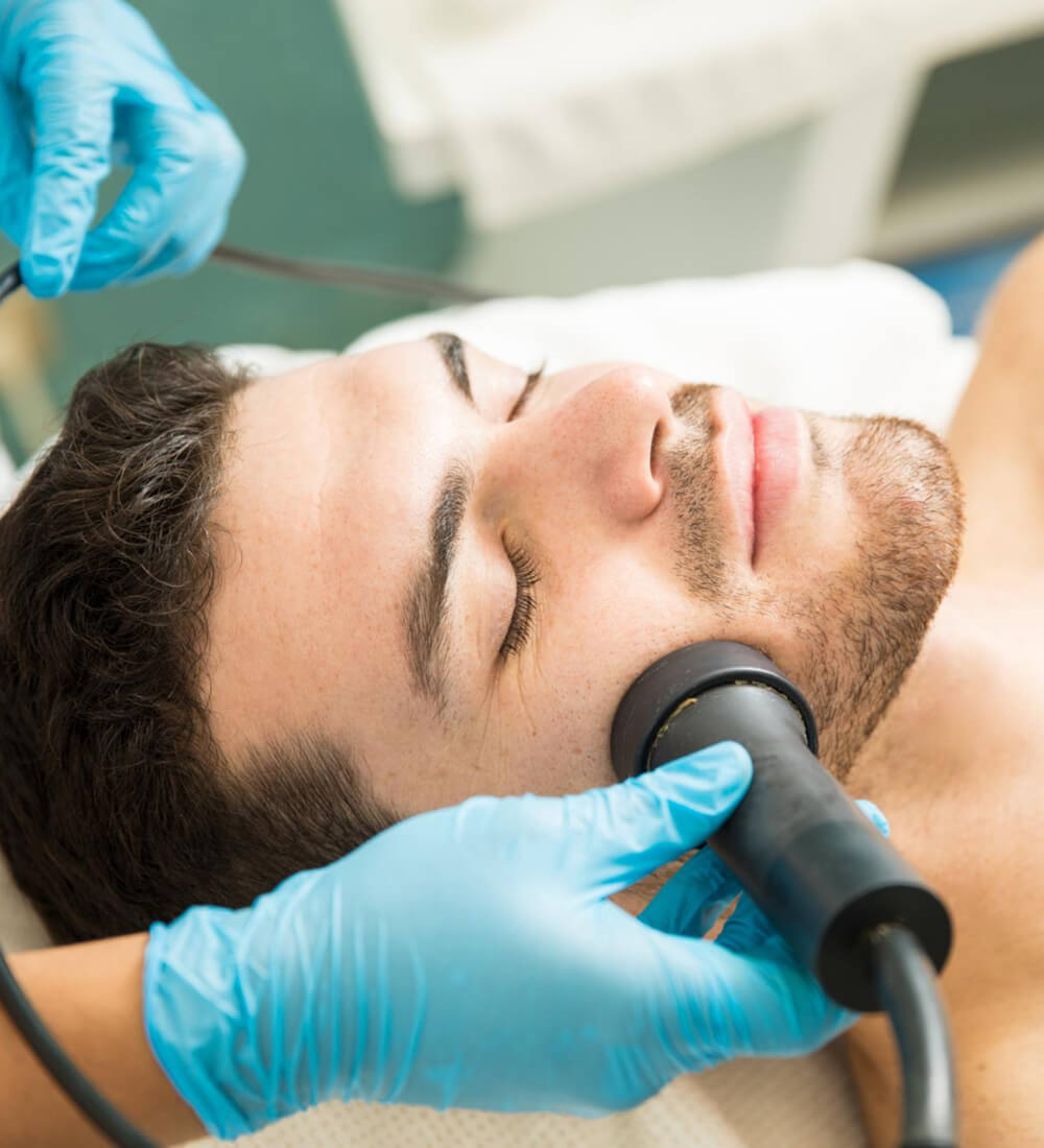 Radiofrekvencija lica